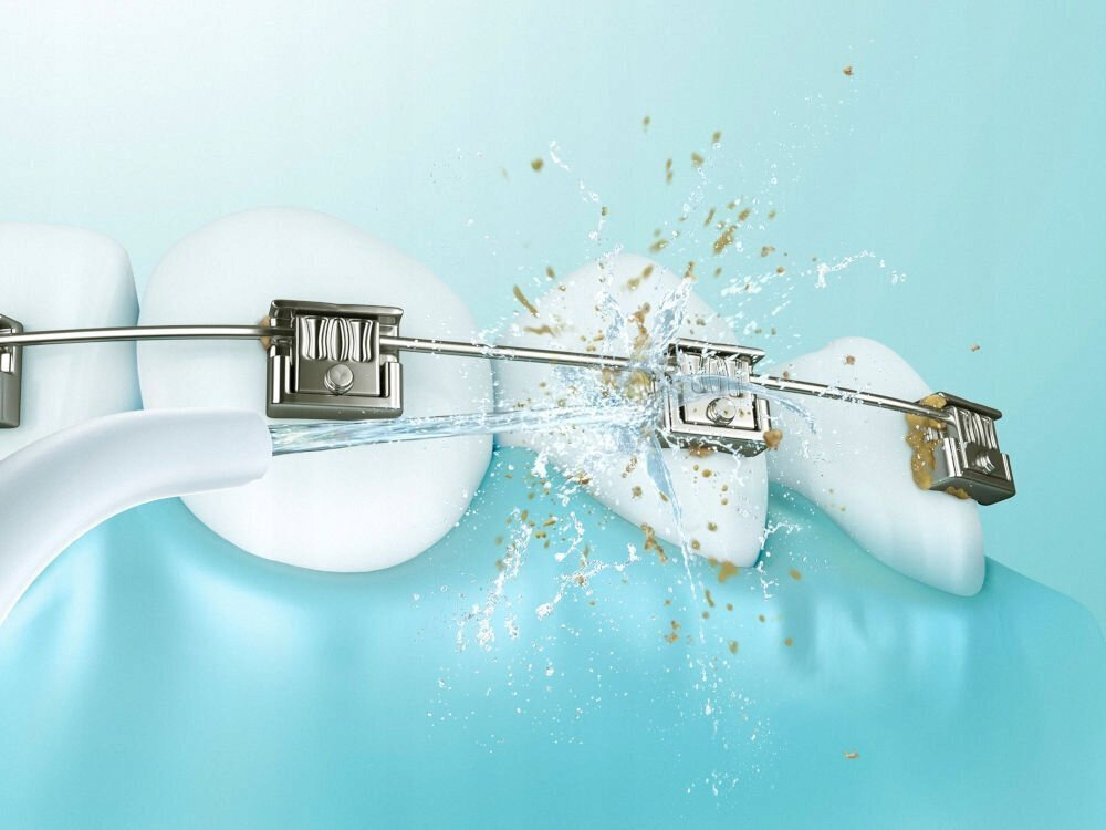 Panasonic Ηλεκτρική Οδοντόβουρτσα - Image 8