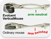 Evoluent VerticalMouse 4 Left Ενσύρματο Εργονομικό Ποντίκι για Αριστερόχειρες Γκρι - Image 2
